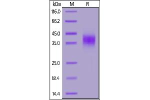 SDS-PAGE (SDS) image for Fc Fragment of IgG, Low Affinity IIIb, Receptor (CD16b) (FCGR3B) (AA 21-206) protein (His tag) (ABIN7013409)