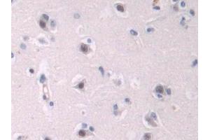 Detection of ENG in Human Cerebrum Tissue using Polyclonal Antibody to Endoglin (ENG) (Endoglin 抗体  (AA 26-136))