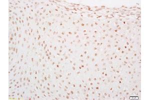 Formalin-fixed and paraffin embedded mouse embryo labeled with Rabbit Anti-LATS2 Polyclonal Antibody, Unconjugated  at 1:200 followed by conjugation to the secondary antibody and DAB staining (LATS1,2 (AA 641-740) 抗体)