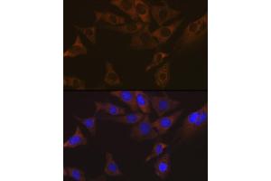 Immunofluorescence analysis of NIH-3T3 cells using V Rabbit mAb (ABIN7271312) at dilution of 1:100 (40x lens).