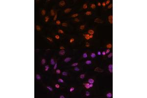Immunofluorescence analysis of C6 cells using Histone H2AFV antibody (ABIN7267555) at dilution of 1:100. (H2AFV 抗体  (AA 1-128))