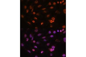Immunofluorescence analysis of C6 cells using Histone H2AFV antibody (ABIN7267555) at dilution of 1:100. (H2AFV 抗体  (AA 1-128))