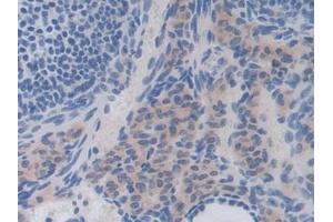 Detection of IL35 in Mouse Ovary Tissue using Polyclonal Antibody to Interleukin 35 (IL35) (Interleukin 35 抗体  (AA 23-215))