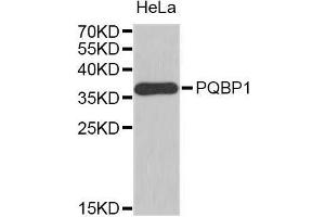 Western Blotting (WB) image for anti-Polyglutamine Binding Protein 1 (PQBP1) (AA 1-265) antibody (ABIN1682273) (PQBP1 抗体  (AA 1-265))