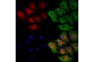 ABIN6263284 and ABIN6272925 staining Hela cells by IF/ICC. (MLYCD 抗体  (Internal Region))