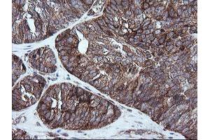Image no. 4 for anti-RIO Kinase 2 (RIOK2) (AA 277-552) antibody (ABIN1491305)