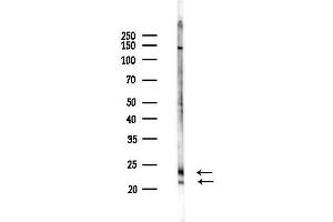 Western blot analysis of lysates from Rat liver, using TM4SF4 Antibody at 1/1000 dilution.