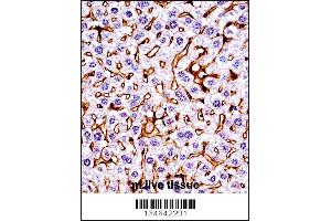 Immunohistochemistry (IHC) image for anti-Macrophage Stimulating 1 Receptor (C-Met-Related tyrosine Kinase) (MST1R) (AA 1013-1041), (C-Term) antibody (ABIN5536953)