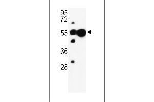 Western blot analysis of UB Antibody (N-term) (ABIN652775 and ABIN2842510) in mouse liver, cerebellum tissue lysates (35 μg/lane). (UBAP1 抗体  (N-Term))