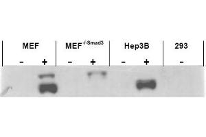 Image no. 1 for anti-SMAD, Mothers Against DPP Homolog 3 (SMAD3) (AA 417-425), (pSer423), (pSer425) antibody (ABIN401332) (SMAD3 抗体  (pSer423, pSer425))