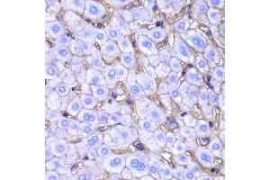 Immunohistochemistry (Paraffin-embedded Sections) (IHC (p)) image for anti-Major Histocompatibility Complex, Class I, A (HLA-A) (AA 35-285) antibody (ABIN3023100)