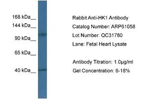Western Blotting (WB) image for anti-Hexokinase 1 (HK1) (Middle Region) antibody (ABIN2788662) (Hexokinase 1 抗体  (Middle Region))