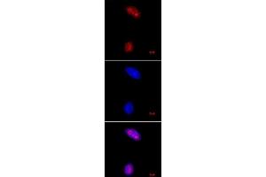 Immunofluorescence (IF) image for anti-Histone 3 (H3) (H3K27me3) antibody (ABIN2668416)