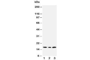 Western Blotting (WB) image for anti-Succinate Dehydrogenase Complex, Subunit C, Integral Membrane Protein, 15kDa (SDHC) (N-Term) antibody (ABIN3032765)