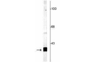 Western blot of rat cortical lysate showing specific labeling of the ~25 kDa SNAP25 protein. (SNAP25 抗体  (C-Term))