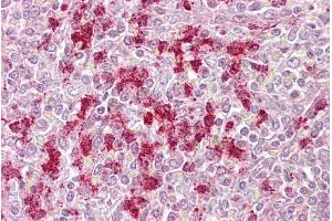 Immunohistochemistry with Spleen tissue at an antibody concentration of 5µg/ml using anti-ZKSCAN4 antibody (ARP39384_P050) (ZKSCAN4 抗体  (N-Term))