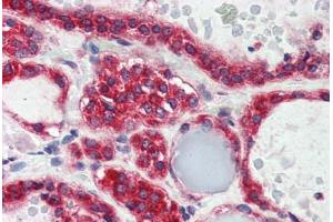 Human Thyroid (formalin-fixed, paraffin-embedded) stained with LPIN3 antibody ABIN337225 at 2. (LPIN3 抗体  (AA 149-160))