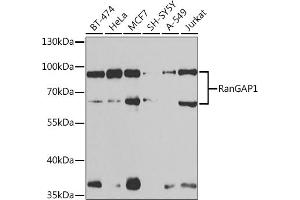 Western blot analysis of extracts of various cell lines, using RanG antibody (ABIN6128613, ABIN6146681, ABIN6146683 and ABIN6217306) at 1:1000 dilution. (RANGAP1 抗体  (AA 398-587))