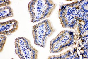 Immunohistochemistry (IHC) image for anti-Heat Shock 10kDa Protein 1 (Chaperonin 10) (HSPE1) (AA 81-102), (C-Term) antibody (ABIN3044176)