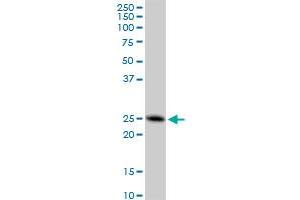 FAM3C monoclonal antibody (M05), clone 3A3. (FAM3C 抗体  (AA 25-227))