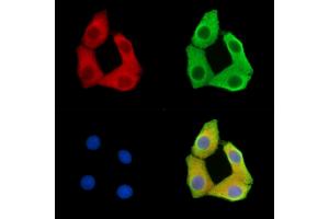 ABIN7095851 and ABIN7099913 staining Hela cells by IF/ICC. (SSX6 抗体)