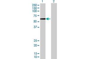 Western Blot analysis of PPP2R5A expression in transfected 293T cell line by PPP2R5A MaxPab polyclonal antibody. (PPP2R5A 抗体  (AA 1-486))