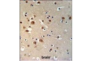 TTBK1 Antibody (N-term) (ABIN1881955 and ABIN2840093) IHC analysis in formalin fixed and paraffin embedded brain tissue followed by peroxidase conjugation of the secondary antibody and DAB staining. (TTBK1 抗体  (N-Term))
