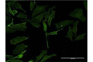 Immunofluorescence of monoclonal antibody to PIM1 on HeLa cell. (PIM1 抗体  (AA 1-313))