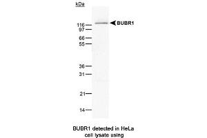 Image no. 1 for anti-Budding Uninhibited By Benzimidazoles 1 Homolog beta (Yeast) (BUB1B) antibody (ABIN363218) (BUB1B 抗体)