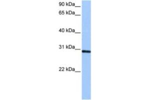 Western Blotting (WB) image for anti-Ankyrin Repeat and SOCS Box-Containing 11 (ASB11) antibody (ABIN2463472) (ASB11 抗体)