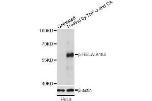 Western blot analysis of extracts of HeLa cells, using Phospho-RELA-S468 antibody (ABIN2988289) at 1/2000 dilution. (NF-kB p65 抗体  (pSer468))