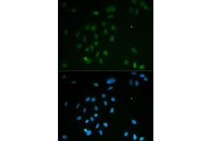 Immunofluorescence analysis of MCF-7 cells using CHEK2 antibody (ABIN5971172). (CHEK2 抗体)