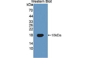 Detection of Recombinant TNFRSF19, Human using Polyclonal Antibody to Tumor Necrosis Factor Receptor Superfamily, Member 19 (TNFRSF19) (TNFRSF19 抗体  (AA 35-160))