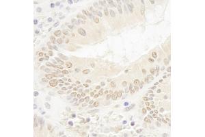 Immunohistochemistry (IHC) image for anti-DOT1-Like, Histone H3 Methyltransferase (S. Cerevisiae) (DOT1L) (AA 1000-1050) antibody (ABIN7448534) (DOT1L 抗体  (AA 1000-1050))