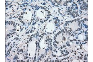 Image no. 7 for anti-Mitogen-Activated Protein Kinase 1 (MAPK1) antibody (ABIN1499291)