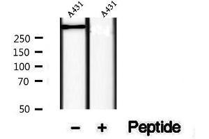 Western blot analysis of extracts of A431 cells, using Phospho-RYR2( Ser2814) Antibody.