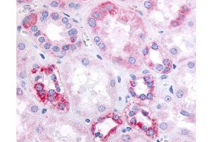 Anti-GPR91 antibody IHC of human kidney, renal tubular epithelium in cortex. (SUCNR1 抗体  (Cytoplasmic Domain))