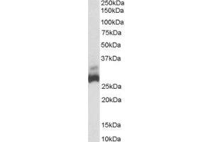 ABIN2559853 (0. (SDHB 抗体  (C-Term))