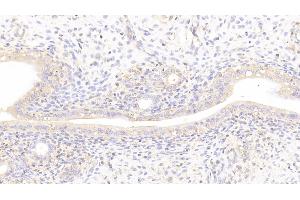 Detection of LAMb2 in Rat Uterus Tissue using Polyclonal Antibody to Laminin Beta 2 (LAMb2) (LAMB2 抗体  (AA 939-1129))