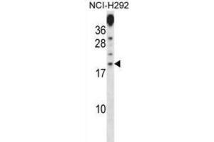 Western Blotting (WB) image for anti-Proline Rich 15 (PRR15) antibody (ABIN2998394) (Proline Rich 15 抗体)