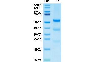 PLAU Protein (AA 21-430) (His tag)