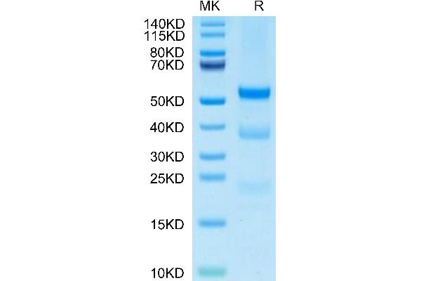 PLAU Protein (AA 21-430) (His tag)