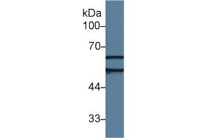 Detection of ACHE in Human Jurkat cell lysate using Polyclonal Antibody to Acetylcholinesterase (ACHE) (Acetylcholinesterase 抗体  (AA 157-332))