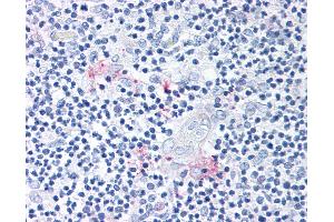 Anti-ROR Gamma antibody IHC of human thymus. (RORC 抗体  (Modulating Domain))
