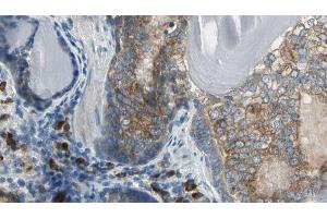 ABIN6276618 at 1/100 staining Human prostate tissue by IHC-P. (Adenylate Kinase 1 抗体  (Internal Region))