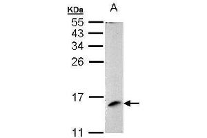 WB Image Sample (30 ug of whole cell lysate) A: 293T 15% SDS PAGE antibody diluted at 1:1000 (MAPKSP1 抗体)