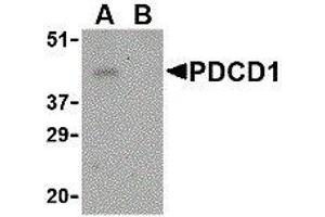 Western Blotting (WB) image for anti-Programmed Cell Death 1 (PDCD1) (Center) antibody (ABIN2479656) (PD-1 抗体  (Center))