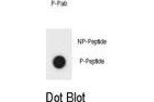 Dot blot analysis of KIT Antibody (Phospho ) Phospho-specific Pab (ABIN1881482 and ABIN2850466) on nitrocellulose membrane. (KIT 抗体  (pSer959))