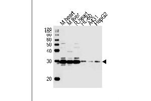 Western blot analysis of lysates from mouse heart, mouse liver, rat heart tissue, HL-60, A431, HepG2 cell line (from left to right), using (DANRE) sdhb Antibody Azb18722a. (SDHB 抗体  (AA 147-182))