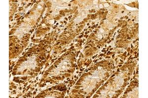 ABIN7094279 and ABIN7098326 at 1/100 staining Rat colon tissue by IHC-P. (HNRNPH3 抗体  (C-Term))